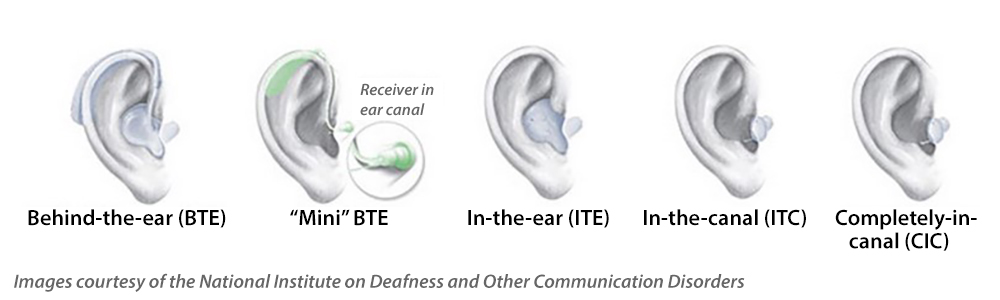 types of hearing aids